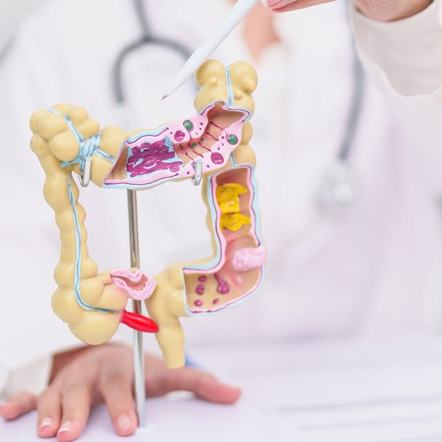 Here’s a surprising fact: the earliest known case of colorectal cancer was found in an …