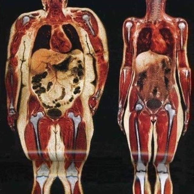 "This image shows a 250 lb woman on the left and a 120 lb woman on the right. We can se…