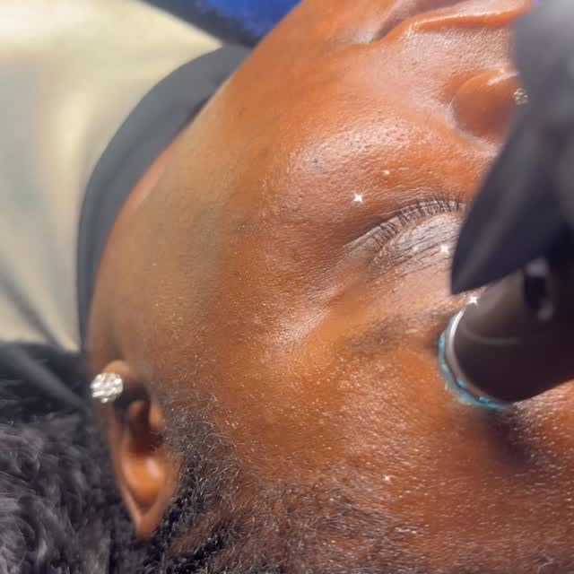 One of my faves having her very first @hydrafacial ✨

Book your very first appointment …