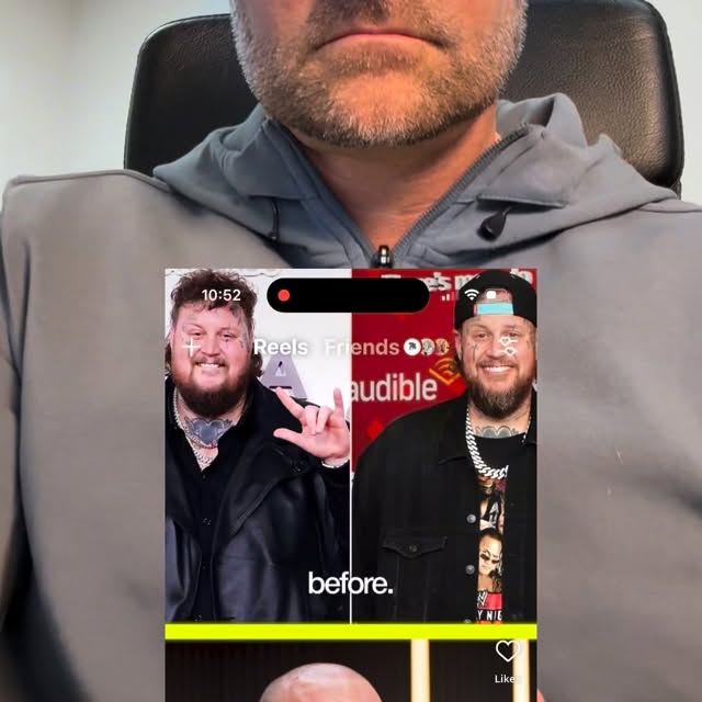 Ozempic face!  We all hear about it, but what really causes it?  It’s not a side effect…